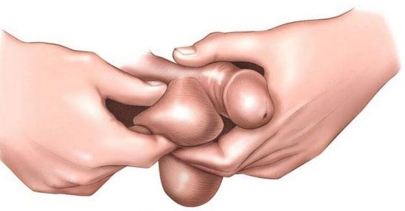 Por qué picazón huevos en los hombres